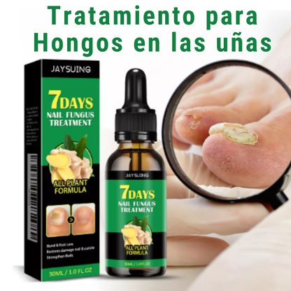 FungiStop® - Elimina el Hongo de tus uñas