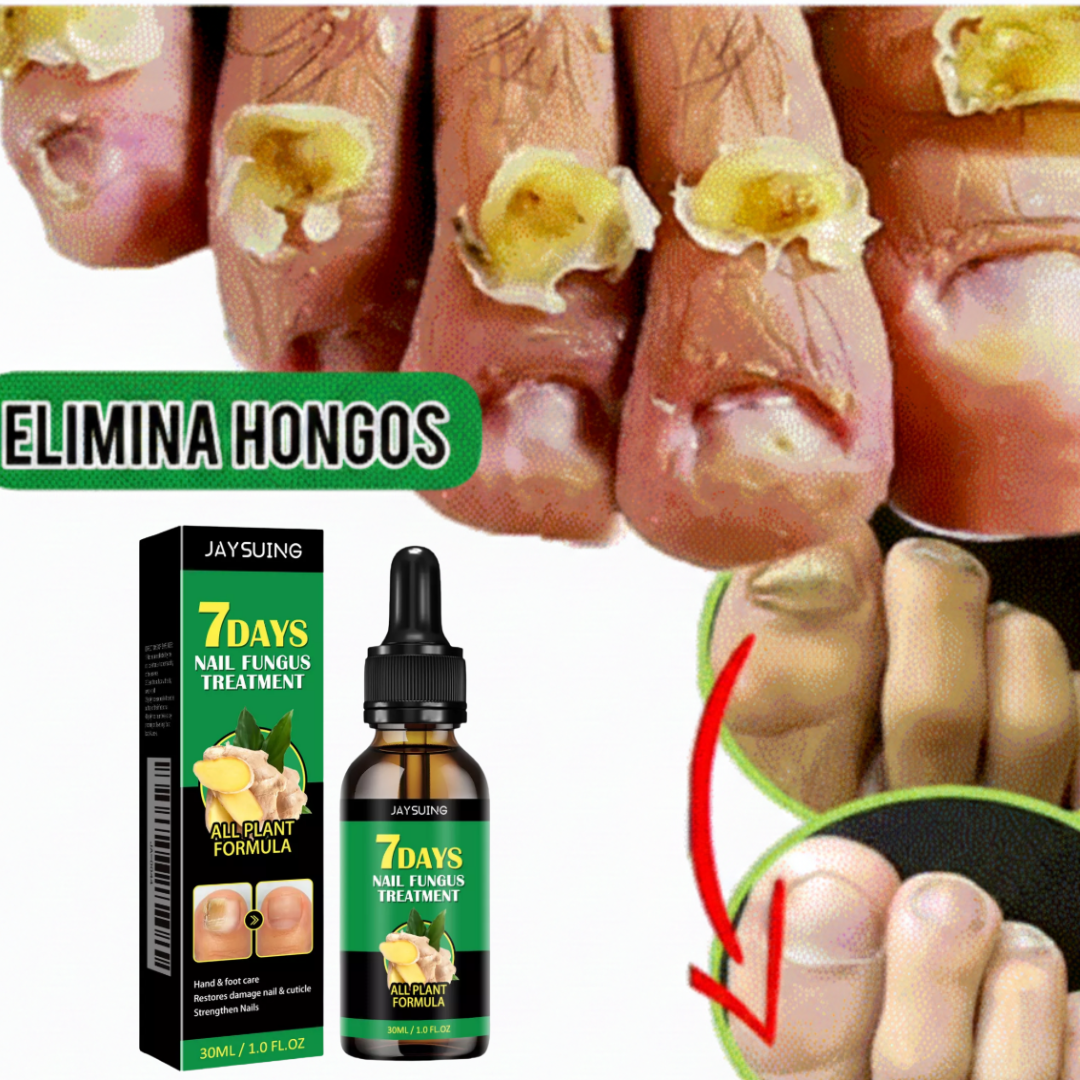 FungiStop® - Elimina el Hongo de tus uñas